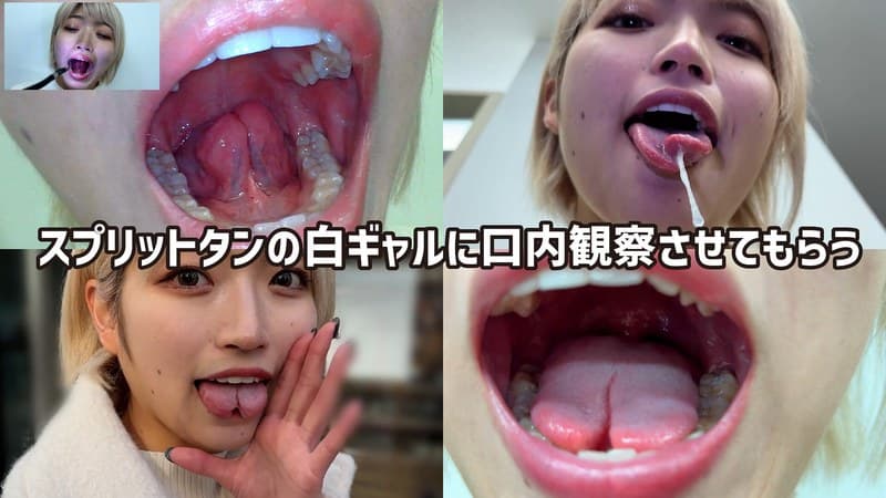 街角で声をかけて口内観察させてもらう 美容部員 はるのちゃん